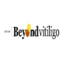 beyondvitiligo.org