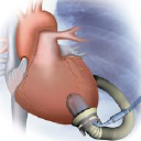 Jarvik Heart, Inc.