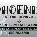 Phoenix Tattoo Removal