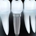pulveroralsurgery