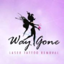 Way Gone Laser Tattoo Removal